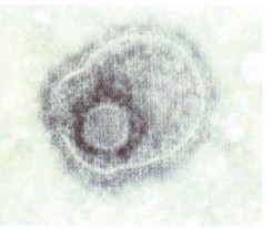 HSV