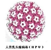 造成尖锐湿疣复发因素有哪些